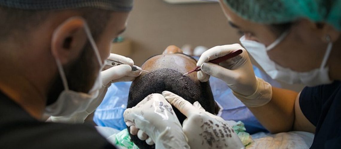 hair-transplant-7518352